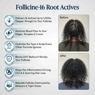 DermDe Hair Regrowth Treatment Kit